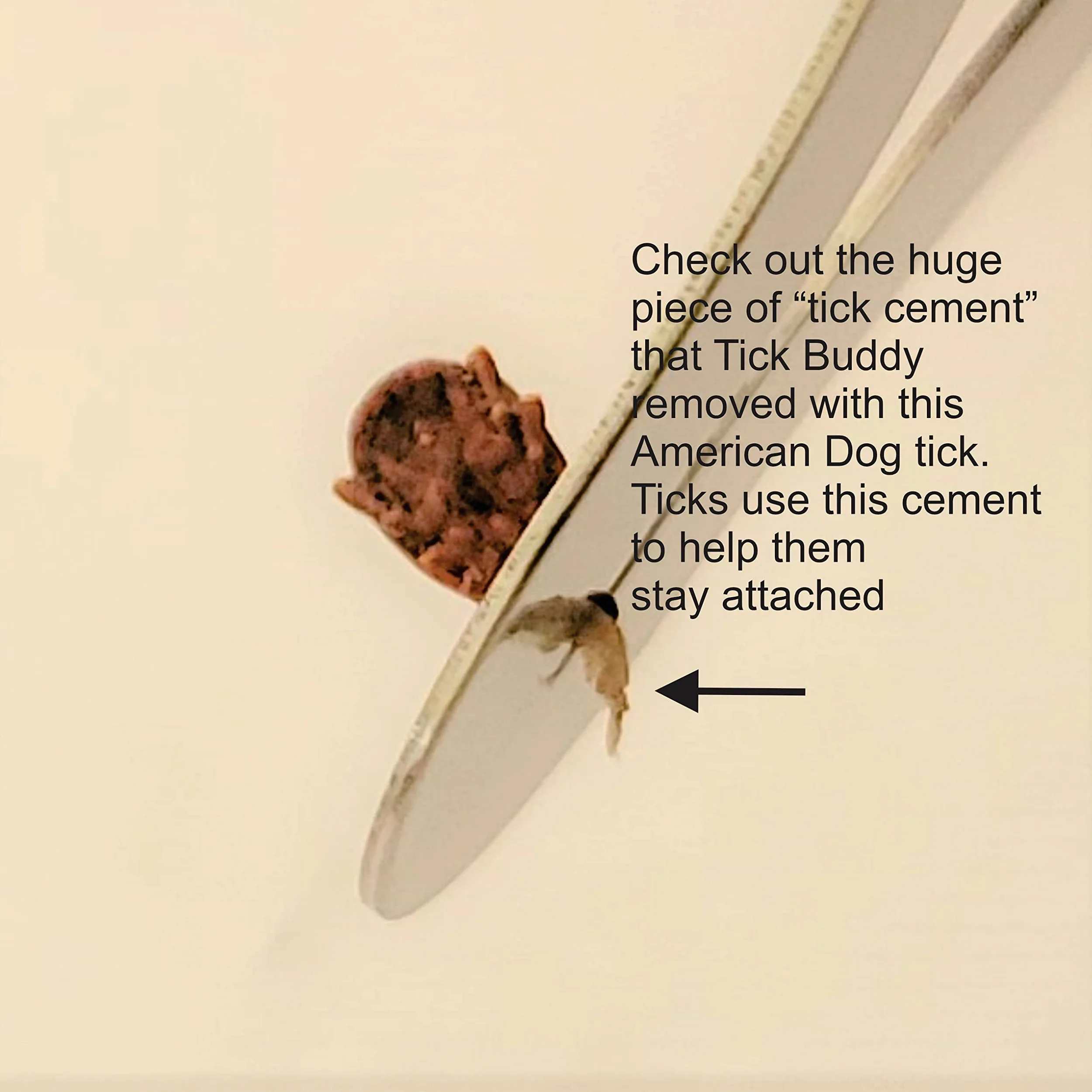 Tick Buddy (trzypak) narzędzie do usuwania kleszczy ze stali nierdzewnej dla psów, kotów, zwierząt domowych i ludzi